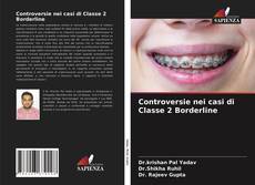 Bookcover of Controversie nei casi di Classe 2 Borderline