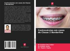 Capa do livro de Controvérsias em casos de Classe 2 Borderline 