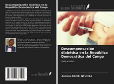 Buchcover von Descompensación diabética en la República Democrática del Congo