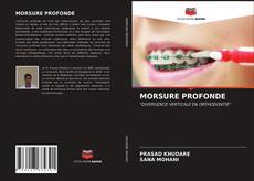 Bookcover of MORSURE PROFONDE