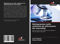 Bookcover of Mielogramma nella sindrome da attivazione dei macrofagi