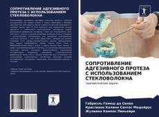 Bookcover of СОПРОТИВЛЕНИЕ АДГЕЗИВНОГО ПРОТЕЗА С ИСПОЛЬЗОВАНИЕМ СТЕКЛОВОЛОКНА