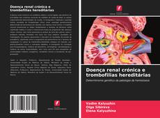 Doença renal crónica e trombofilias hereditárias kitap kapağı