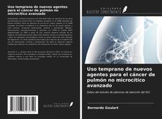Capa do livro de Uso temprano de nuevos agentes para el cáncer de pulmón no microcítico avanzado 