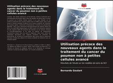 Buchcover von Utilisation précoce des nouveaux agents dans le traitement du cancer du poumon non à petites cellules avancé