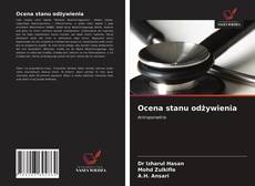 Bookcover of Ocena stanu odżywienia