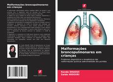 Couverture de Malformações broncopulmonares em crianças