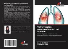 Bookcover of Malformazioni broncopolmonari nei bambini