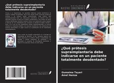 Borítókép a  ¿Qué prótesis supraimplantaria debe indicarse en un paciente totalmente desdentado? - hoz