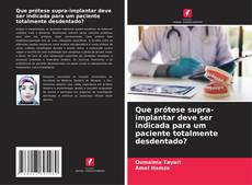 Couverture de Que prótese supra-implantar deve ser indicada para um paciente totalmente desdentado?