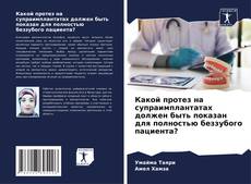 Capa do livro de Какой протез на супраимплантатах должен быть показан для полностью беззубого пациента? 