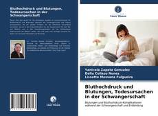 Обложка Bluthochdruck und Blutungen, Todesursachen in der Schwangerschaft