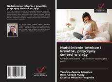 Bookcover of Nadciśnienie tętnicze i krwotok, przyczyny śmierci w ciąży