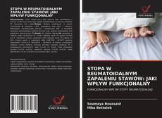 Bookcover of STOPA W REUMATOIDALNYM ZAPALENIU STAWÓW: JAKI WPŁYW FUNKCJONALNY