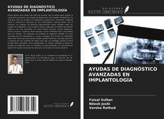 Buchcover von AYUDAS DE DIAGNÓSTICO AVANZADAS EN IMPLANTOLOGÍA