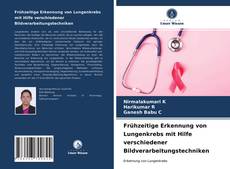 Couverture de Frühzeitige Erkennung von Lungenkrebs mit Hilfe verschiedener Bildverarbeitungstechniken