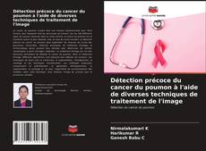 Capa do livro de Détection précoce du cancer du poumon à l'aide de diverses techniques de traitement de l'image 
