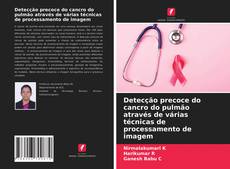 Borítókép a  Detecção precoce do cancro do pulmão através de várias técnicas de processamento de imagem - hoz