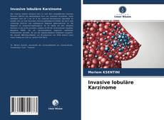 Bookcover of Invasive lobuläre Karzinome