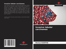 Couverture de Invasive lobular carcinomas