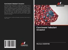 Bookcover of Carcinomi lobulari invasivi