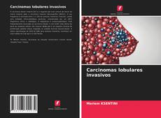 Capa do livro de Carcinomas lobulares invasivos 