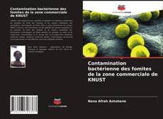 Bookcover of Contamination bactérienne des fomites de la zone commerciale de KNUST