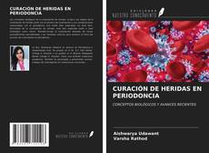 Couverture de CURACIÓN DE HERIDAS EN PERIODONCIA