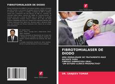 Borítókép a  FIBROTOMIALASER DE DIODO - hoz