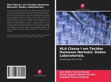 Capa do livro de HLA Classe I em Tecidos Humanos Normais: Dados Laboratoriais. 