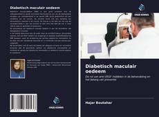 Bookcover of Diabetisch maculair oedeem