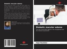 Capa do livro de Diabetic macular edema 