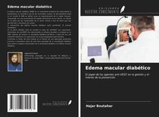 Portada del libro de Edema macular diabético