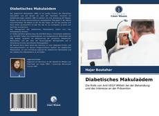 Buchcover von Diabetisches Makulaödem