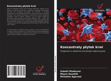 Bookcover of Koncentraty płytek krwi