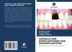 Couverture de AUSFÄLLE UND KOMPLIKATIONEN VON ZAHNIMPLANTATEN