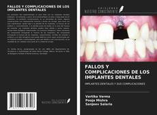 Buchcover von FALLOS Y COMPLICACIONES DE LOS IMPLANTES DENTALES