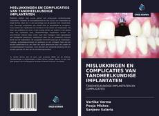 Bookcover of MISLUKKINGEN EN COMPLICATIES VAN TANDHEELKUNDIGE IMPLANTATEN