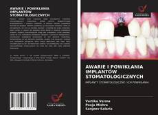 Bookcover of AWARIE I POWIKŁANIA IMPLANTÓW STOMATOLOGICZNYCH