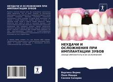 Portada del libro de НЕУДАЧИ И ОСЛОЖНЕНИЯ ПРИ ИМПЛАНТАЦИИ ЗУБОВ