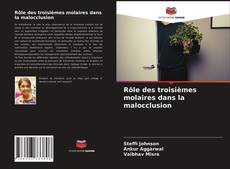 Copertina di Rôle des troisièmes molaires dans la malocclusion