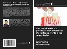 Обложка Una revisión de las prótesis sobre implantes atornilladas frente a las cementadas