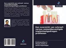 Capa do livro de Een overzicht van schroef- versus cementbevestigde implantaatgedragen prothesen 