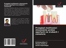 Bookcover of Przegląd możliwości stosowania protez opartych na śrubach i cemencie