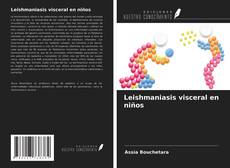 Bookcover of Leishmaniasis visceral en niños