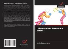 Bookcover of Leiszmanioza trzewna u dzieci