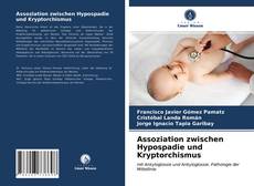 Buchcover von Assoziation zwischen Hypospadie und Kryptorchismus