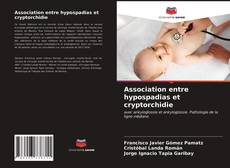 Copertina di Association entre hypospadias et cryptorchidie