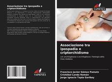 Bookcover of Associazione tra ipospadia e criptorchidismo