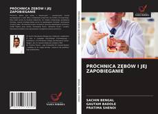 Bookcover of PRÓCHNICA ZĘBÓW I JEJ ZAPOBIEGANIE